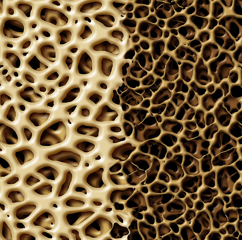 Photo of bone density testing