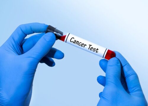 Photo of a cancer test