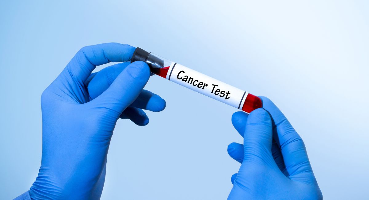 Galleri Cancer Test: The Benefits of Early Cancer Screening