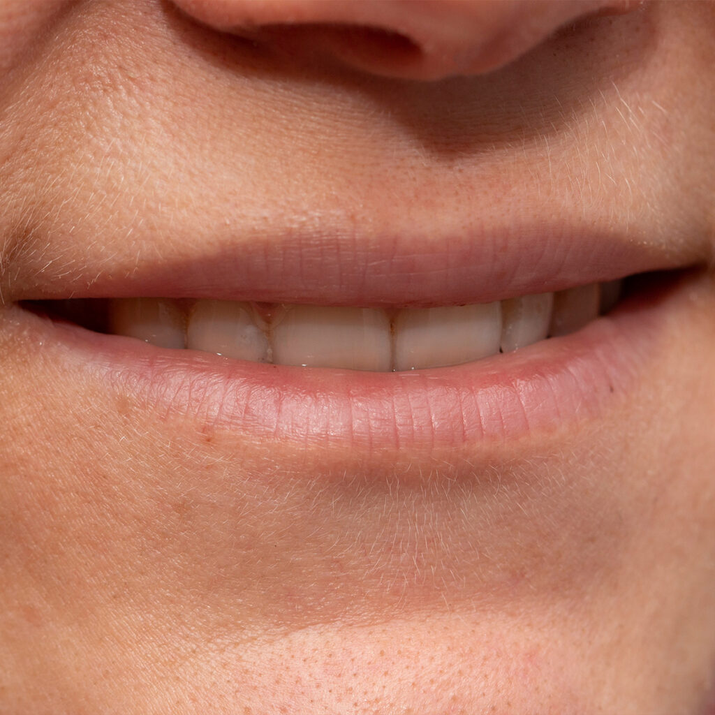 Photo of a person's thin lips