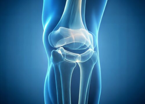 An x-ray photo of a human knee joint